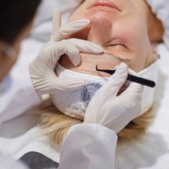 DS V-Line Collageen Draadlift behandeling